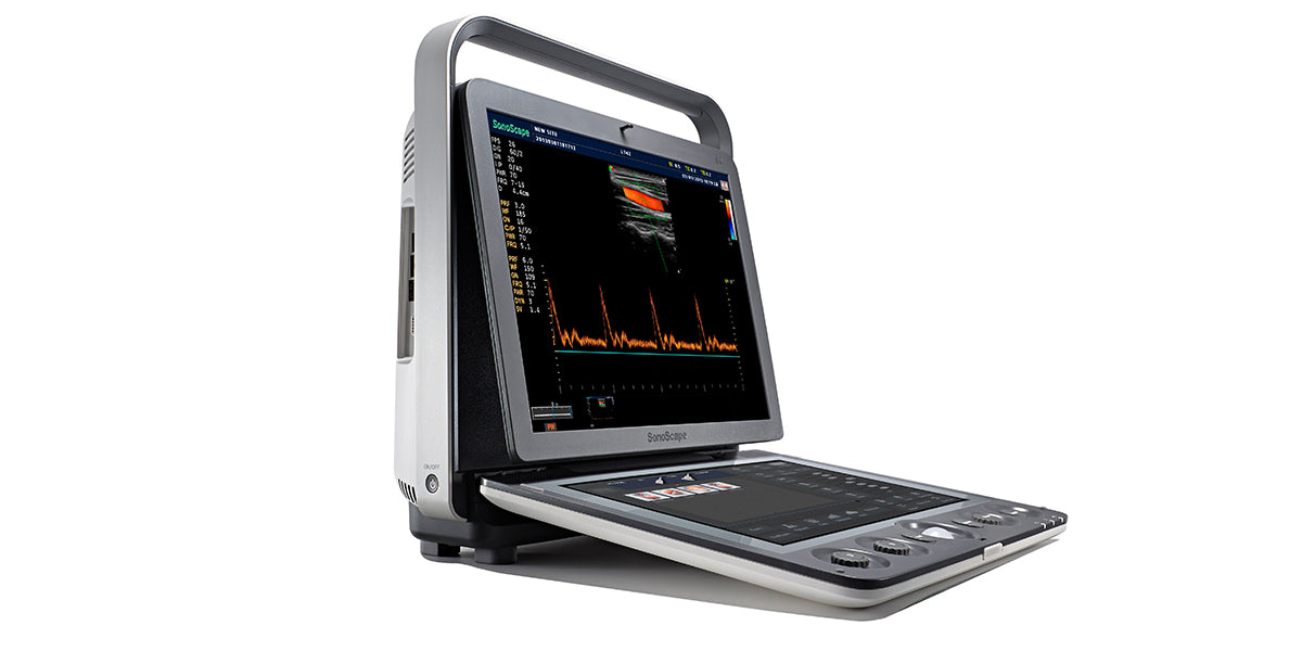 Sonoscape S9Ultrasound Colour Doppler - 1