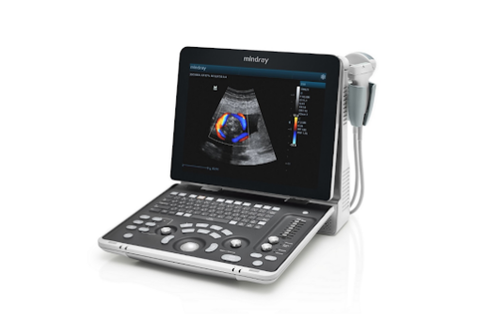 UltraSound Z 50 met konvekse en TVS-sonde