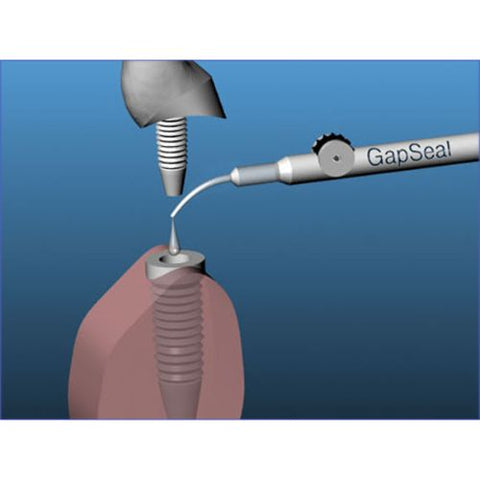 Hager & Werken – GapSeal