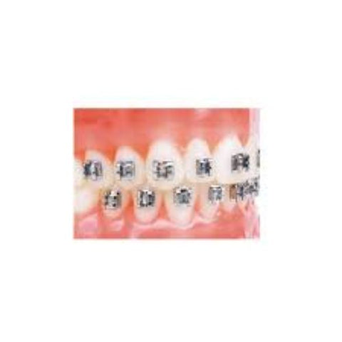 Ortho Arch – 022 Mini Edgewise vs Double Bo-onderste Cuspid