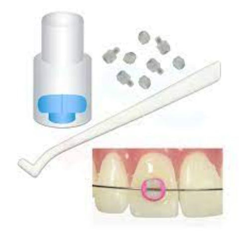 أطراف ومقابض أداة ربط الأقواس Ortho Arch