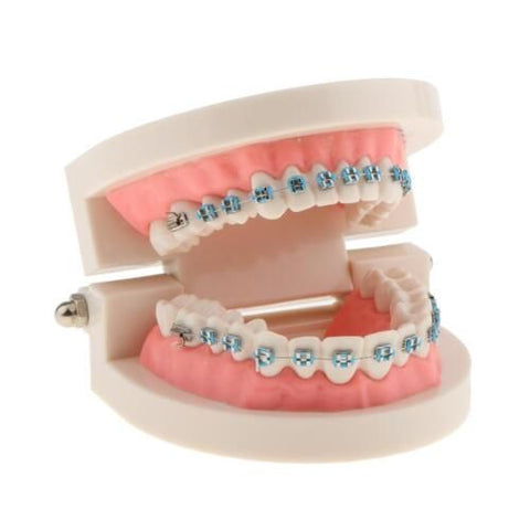 Ortho Arch – Tipodant Conlin Light Wire 5×5