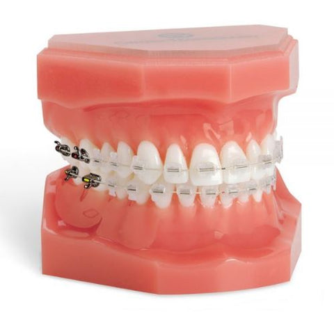 Ortho Arch – Typodont Nova C 5X5 met hakies