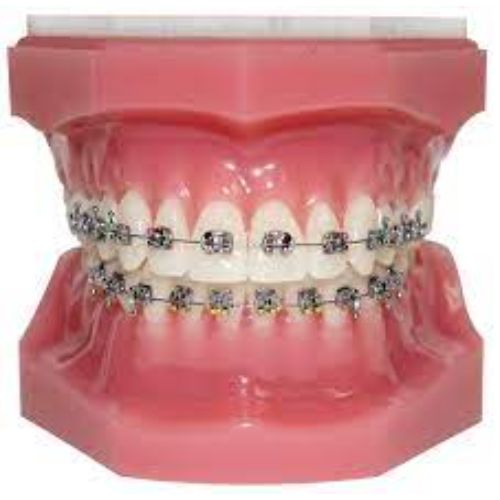Ortho Arch – Typodont Nova S 5X5 met hakies