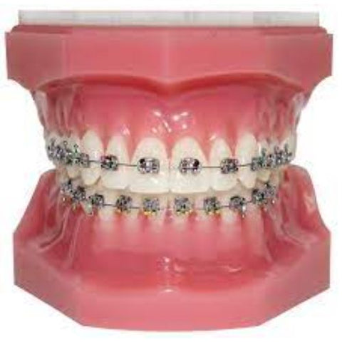 Ortho Arch – Typodont Nova S 5X5 met hakies