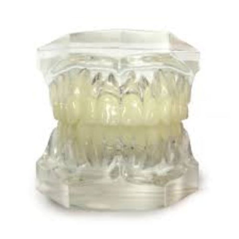 Ortho Arch – Duidelike geartikuleerde typodont
