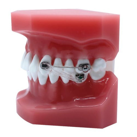 Ortho Arch – D2 Toestel