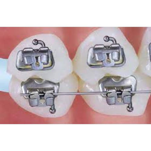 Ortho Arch – Halo Molar Band En Buccale Tube En Knoppie
