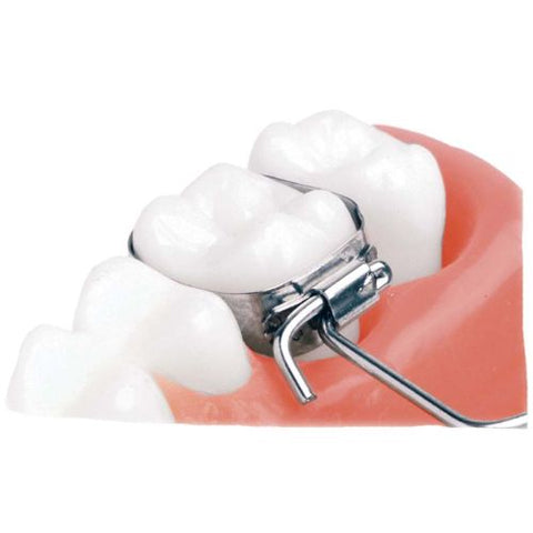 Ortho Arch – Talige skede