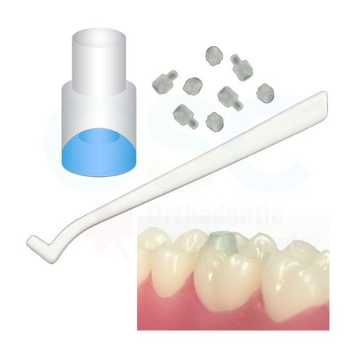 Ortho Arch – Posterior Molêre Pad Wenke en Hanteer