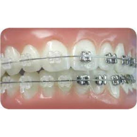 Ortho Arch – UL/LR Conlin Ligdraad Saamgestelde Hakies Sentraal Lateraal
