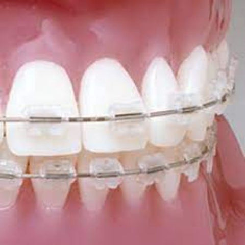 Ortho Arch – UR/LL Conlin Ligdraad Saamgestelde Hakies Sentraal Lateraal