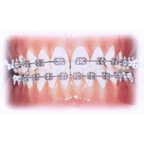 Ortho Arch - UR / LL Conlin Light Wire Saamgestelde Brackets Cuspid Bicuspid