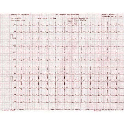 Telepaper Malaysia – ECG Paper Bionet Cardiocare 2000/3000 ( With Graph) (CSO)