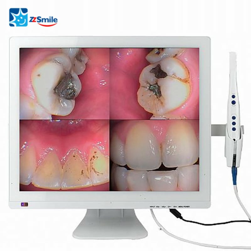 Intra Oral Camera With Screen - 1 set