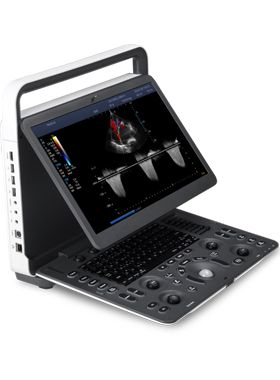 SONOSCAPE PORTABLE ULTRASOUND E2 EXP - 1