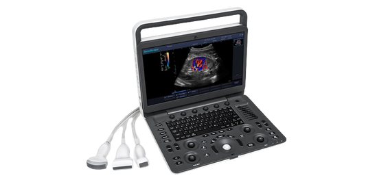 SONOSCAPE PORTABLE ULTRASOUND MACHINE E3 - 1