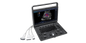 SONOSCAPE PORTABLE ULTRASOUND MACHINE E3 - 1