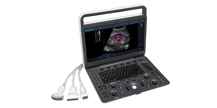 SONOSCAPE PORTABLE ULTRASOUND MACHINE E3 - 1