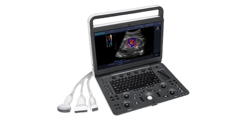 SONOSCAPE PORTABLE ULTRASOUND MACHINE E3 - 1