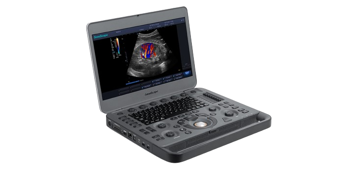 SONOSCAPE PORTABLE ULTRASOUND MACHINE X3 - 1