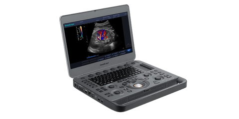 SONOSCAPE PORTABLE ULTRASOUND MACHINE X3 - 1