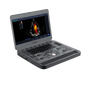 SONOSCAPE PORTABLE ULTRASOUND MACHINE X5 - 1
