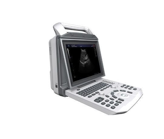 Portable ultrasound system zoncare-i50 - 1