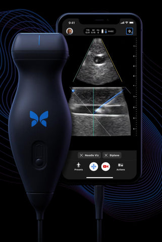 PORTABLE ULTRASOUND SYSTEM - BUTTERFLY IQ