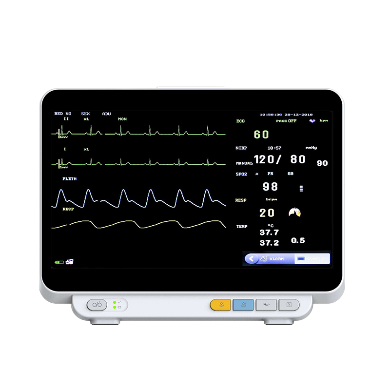 "12-inch multi-parameter patient monitor displaying vital signs in real time