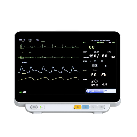 "12-inch multi-parameter patient monitor displaying vital signs in real time