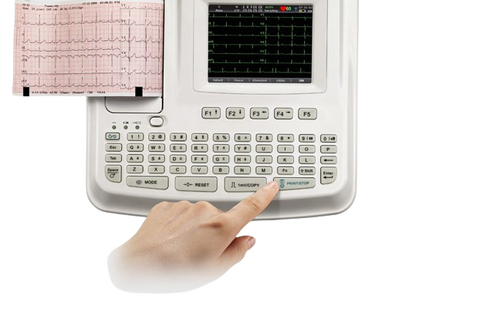 Edan ECG Machine SE-601 Series 6-Channel ECG - 1