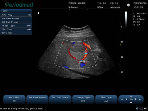 Buy Portable Color Doppler Ultrasound System PU-L151B – Available at Yonker, Periodmed & AdamsMed – UAE & Africa