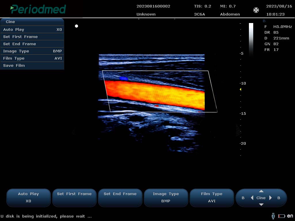 Buy Portable Color Doppler Ultrasound System PU-L151B – Yonker | Periodmed | AdamsMed – UAE & Africa