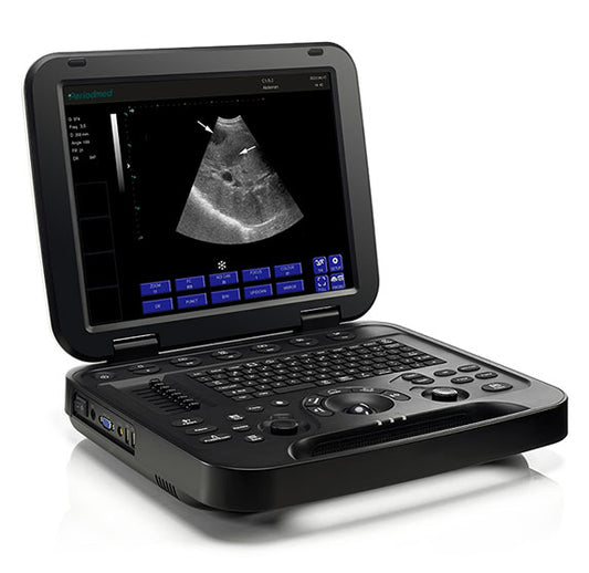 15-inch black and white ultrasound with convex probe from a medical equipment supplier