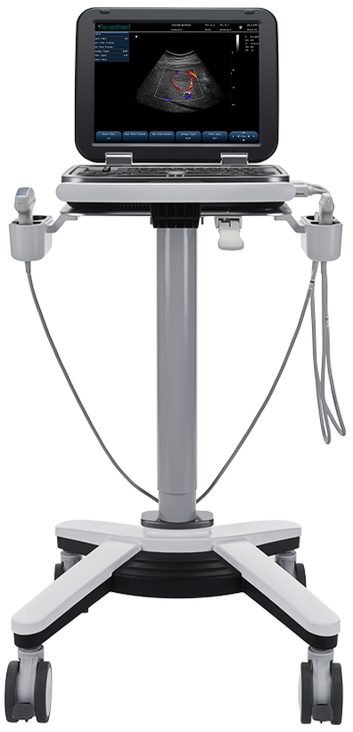 Buy Portable Color Doppler Ultrasound System PU-L151B – Available at Yonker, Periodmed & AdamsMed – UAE & Africa