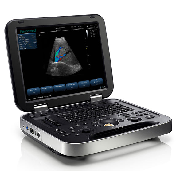 A medical ultrasound image with color Doppler showing blood flow in real-time
