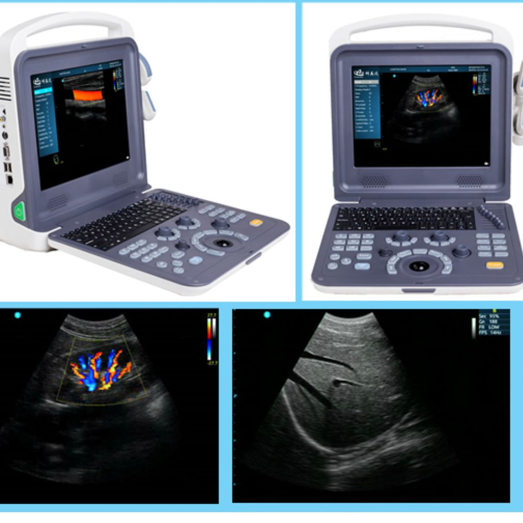 Portable Color doppler  ultrasound with two probes - 1 set