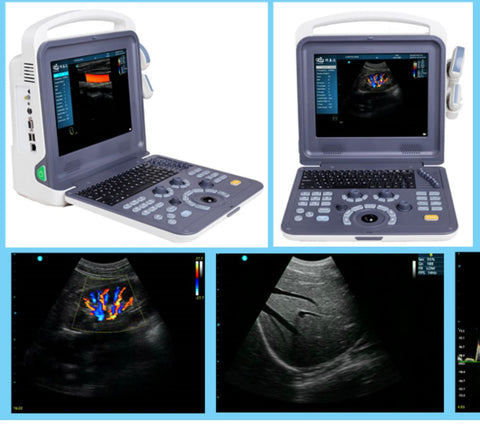 Portable Color doppler  ultrasound with two probes - 1 set