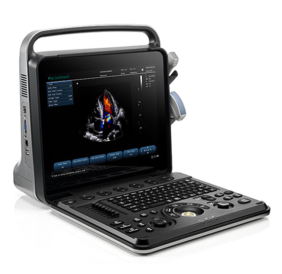 Color Doppler Ultrasound 15 inch (PU-P151A British) with Convex probe for precise imaging in UAE clinics and hospitals