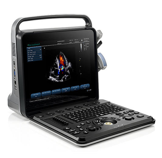 Color Doppler Ultrasound 15 inch (PU-P151A British) with Convex probe for precise imaging in UAE clinics and hospitals