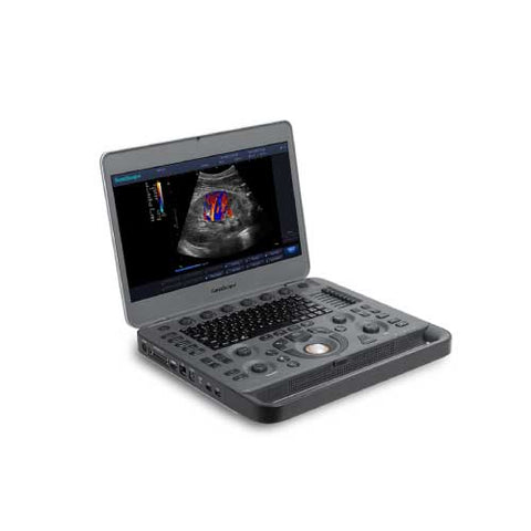 X3 portable color Doppler with abdominal probe