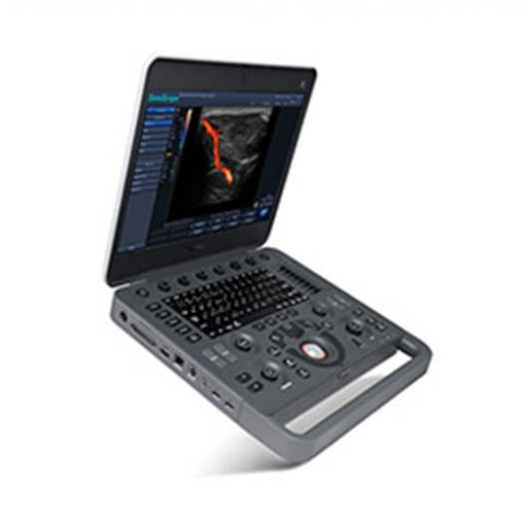 X5 portable color Doppler with abdominal probe