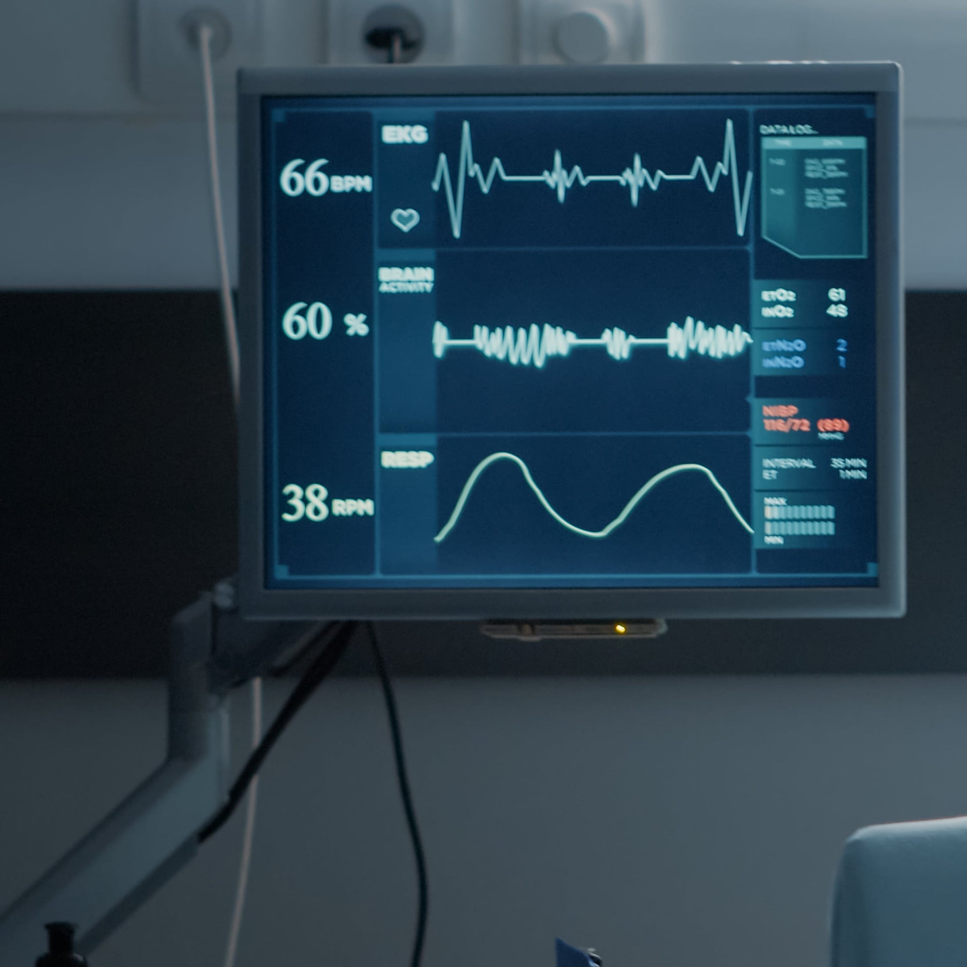 Medical monitor displaying vital signs in an operating room setting