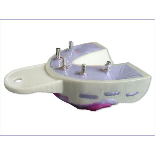 Hager &amp; Werken – Mira Tray Implant