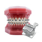 Ortho Arch – Bracketed Typodont Nustar Gen2 7×7