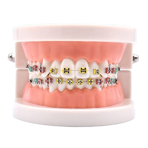 Ortho Arch – Teeth Model