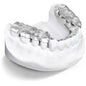 Ortho Arch – TMJ Appliance