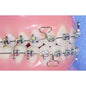 Ortho Arch – UL/LR Conlin Light Wire Composite Brackets Cuspid Bicuspid