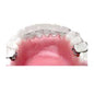 Ortho Arch – Wire Bonder Klein wenke en handvatsel
